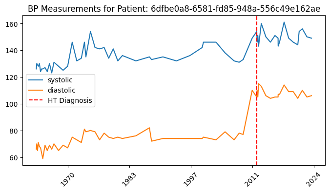 Blood pressure Measurements for one patient over time, including a vertical line for when they got diagnosed with hypertension